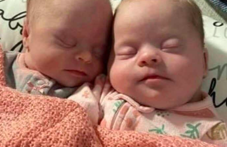 Florida Woman Gives Birth To Rare Set Of Identical Twins With Down ...