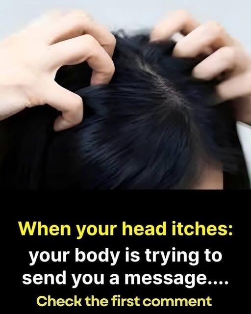Itchy Scalp? Here Are the Most Common Causes Behind Persistent Irritation, Flaking, Redness, and Discomfort, From Dry Skin and Dandruff to Allergies, Product Buildup, Stress, Weather Changes, Infections, Hormonal Shifts, Poor Hygiene, Overwashing, and Underlying Conditions That Often Go Ignored By Many People Seeking Relief Without Understanding the Root Problem